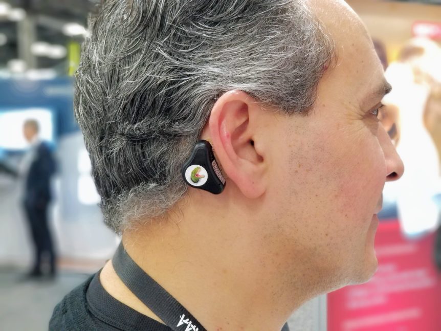 ADHEAR A Revolutionary NonSurgical Bone Conduction Hearing Device